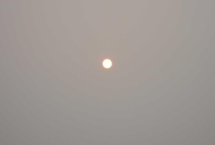 隆胸填充物可能引發(fā)癌癥,美國(guó)愛(ài)力根艾爾建全球召回